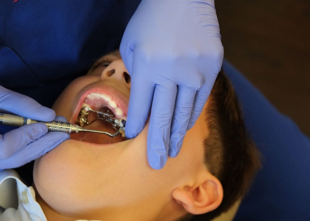 Orthodontie Enfants à Villeneuve d’Ascq (2)