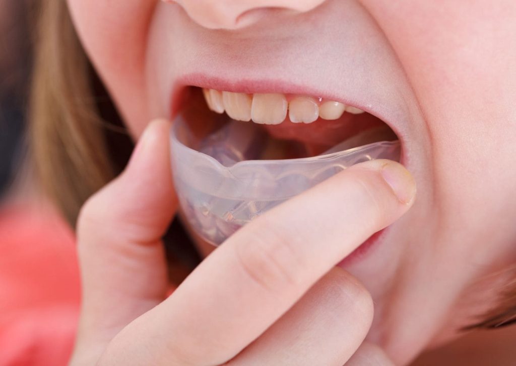 Orthodontie Enfants à Villeneuve d’Ascq (5)