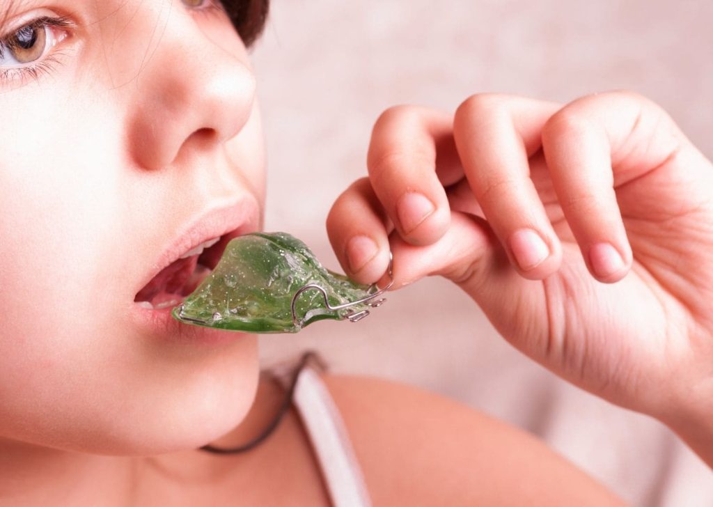 Orthodontie Enfants à Villeneuve d’Ascq (6)