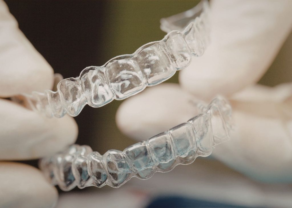 Orthodontie Invisible à Villeneuve d’Ascq