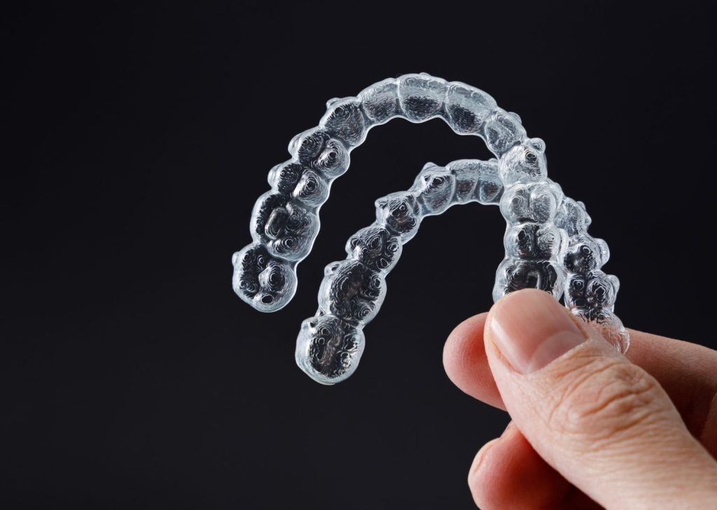 Orthodontie Invisible à Villeneuve d’Ascq (2)