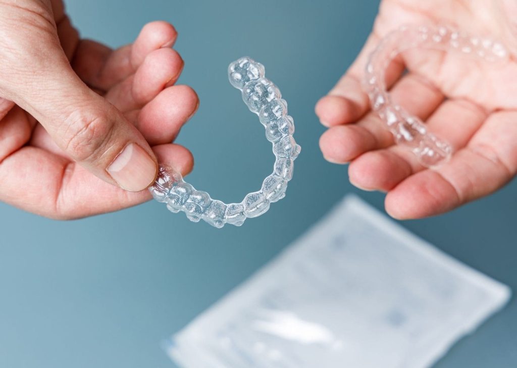 Orthodontie Invisible à Villeneuve d’Ascq (7)