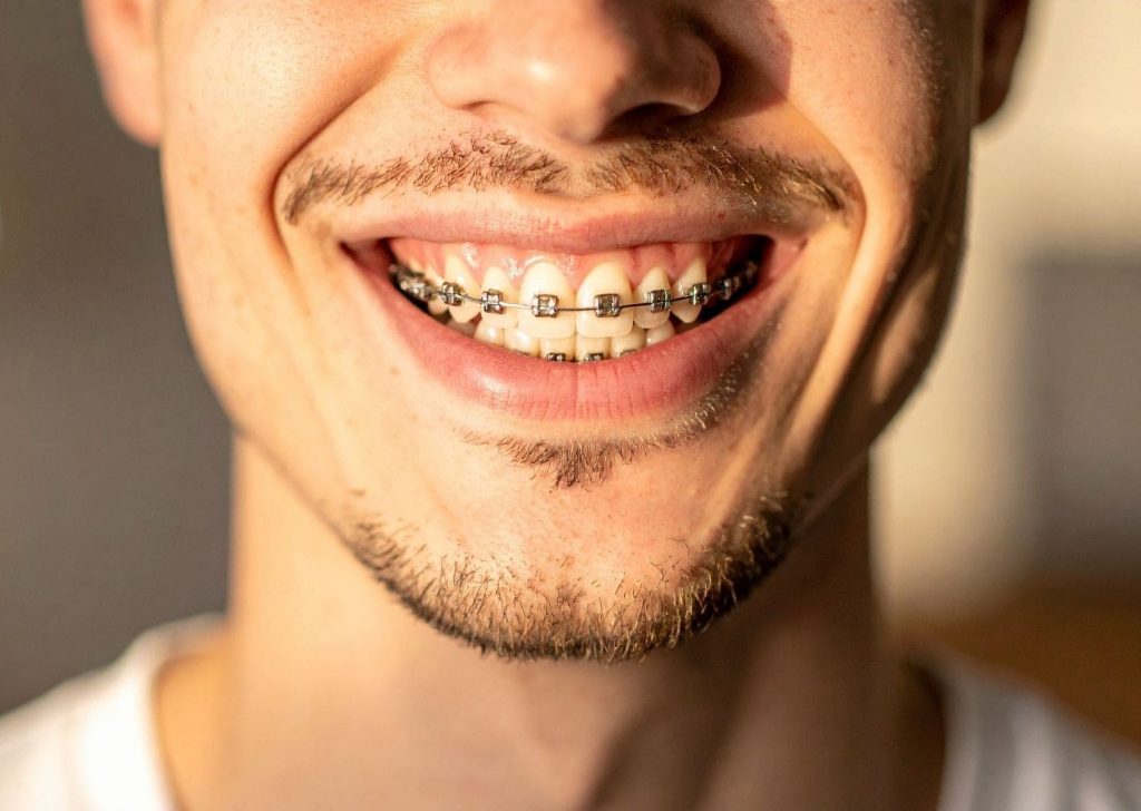 Orthodontie adultes à Villeneuve d’Ascq (9)